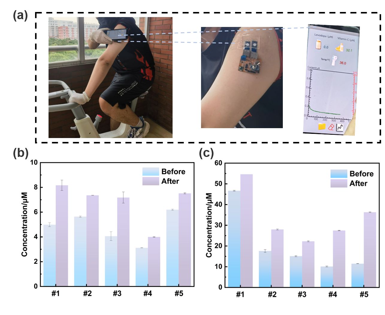Figure 3 (a) On-body application of the flexible sweat-sensing system. (b) Changes in sweat levodopa concentration after a meal in five volunteers. (c) Changes in sweat vitamin C concentration af.jpg
